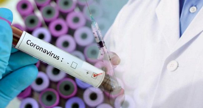 Дрогобич закуповує 300 експер-тестів на виявлення коронавірусу
