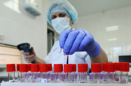 Виконком затвердив тарифи: Пройти ІФА-тестування на коронавірус можна у Дрогобичі та Стебнику