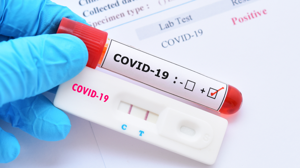 За тиждень на Дрогобиччині виявили 134 випадки захворювання на коронавірус